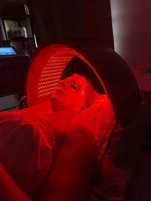 Terapia de luz LED roja para rejuvenecimiento